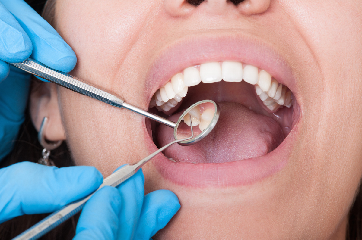Image result for Oral Hygiene
